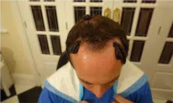 هیرودو تراپی چیست