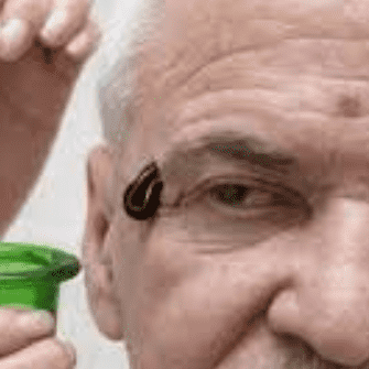 خواص معجزه گر زالو