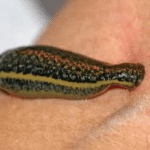 ویژگی زالو طبی و آرایشی بهداشتی