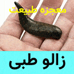 زالو درمانی