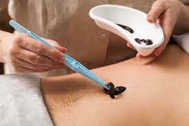 زالو درمانی چیست