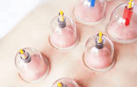 حجامت چیست؟