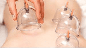 آب زرد در حجامت چیست؟