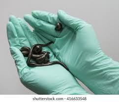 مسمومیت: زالوهای غیرقانونی ممکن است در معرض مواد سمی موجود در محیط خود قرار گیرند که می‌توانند آن را به انسان منتقل کنند.